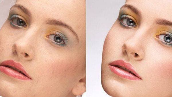 Ретушь beauty-портрета методами частотного разложения и Dodge&amp;Burn