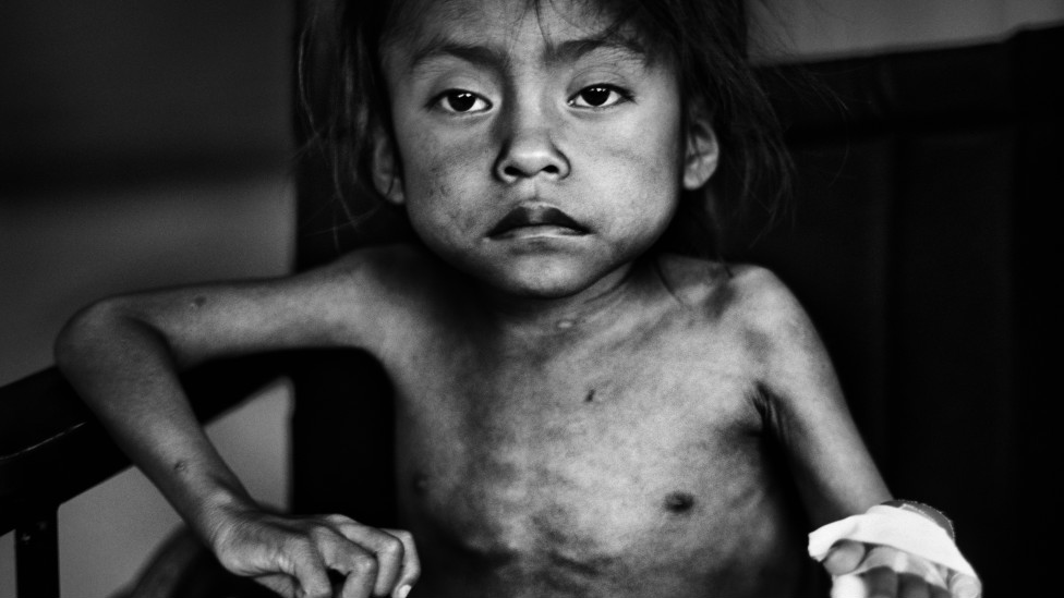 UNICEF Photo of the Year 2011 / Photo: JM Lopez